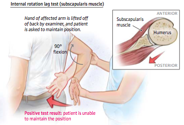 SGEM#74: Broken Arms (Diagnosing Rotator Cuff Disease) | The Skeptics