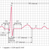 SGEM#76: And the Beat Goes On (Azithromycin and Risk of Cardiovascular Death)