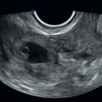 SGEM#105: Does this Woman Have an Ectopic Baby, Baby?