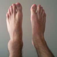 SGEM#191: No Time for Physio – Roll With It