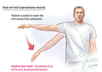 SGEM#74: Broken Arms (Diagnosing Rotator Cuff Disease) | The Skeptics ...