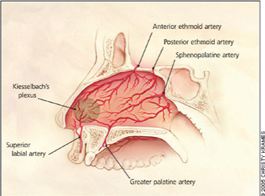 SGEM#210: (Don’t) Let it Bleed – TXA for Epistaxis in Patients on Anti ...